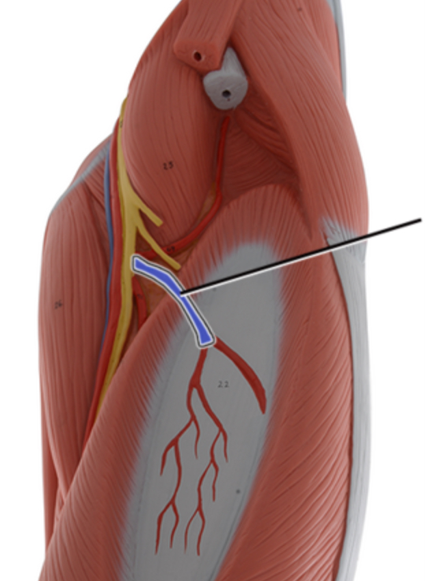 <p>Name this artery.</p>