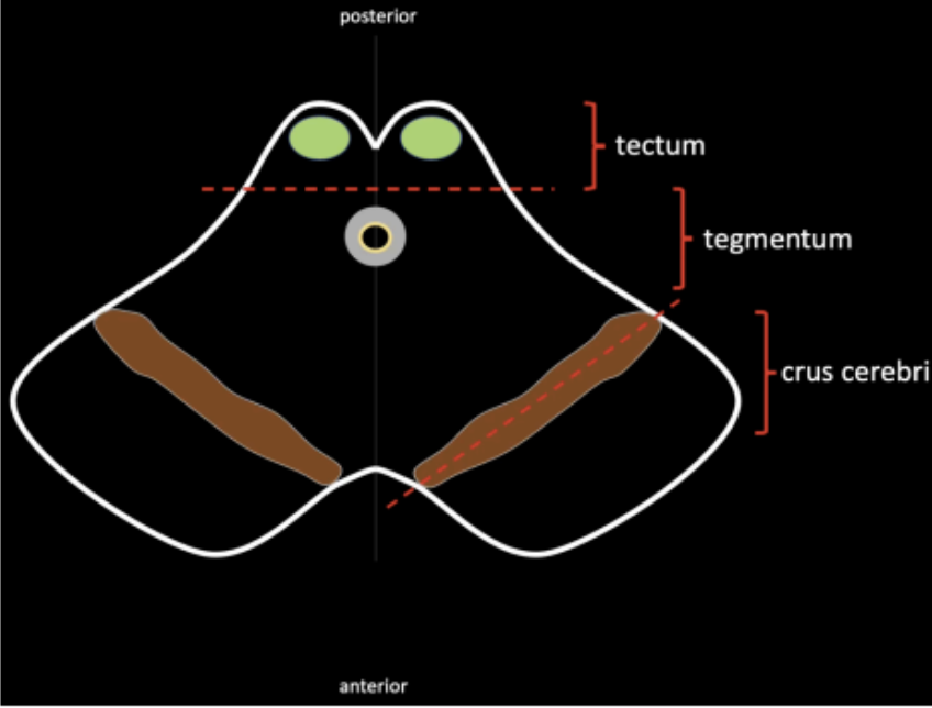 <p><strong>superior colliculus</strong></p>