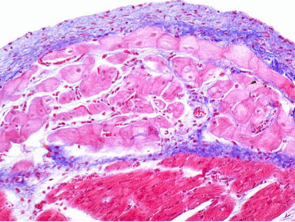 <p>What are these structures?</p><p>endocardium </p><p>purkinje fiber</p><p>myocardium </p>
