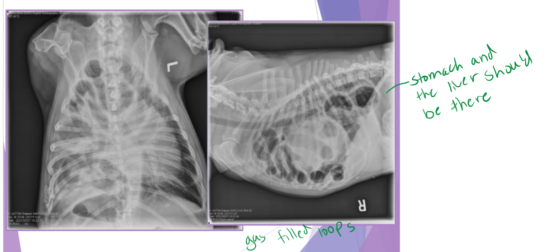 <ul><li><p>very common </p></li><li><p>continuity of the diaphragm is disrupted </p><ul><li><p>abdominal organs migrate into the thorax </p></li></ul></li><li><p>due to an alteration in pressure gradient </p><ul><li><p>acute </p><ul><li><p>shock, associated injuries, respiratory difficulty </p></li></ul></li><li><p>chronic </p><ul><li><p>respiratory dyspnea, exercise intolerance, nonspecific (ADR) </p></li></ul></li></ul></li><li><p>signalment: no breed predisposition </p></li><li><p>tear often occur in weakest area - through muscle </p></li><li><p>diagnostic evaluation </p><ul><li><p>thoracic radiographs (65% accurate) </p><ul><li><p>pleural effusion </p></li><li><p>gas/soft tissue opacity within the thoracic cavity </p></li><li><p>stomach against the diaphragm </p></li><li><p>loss of diaphragm silhouette </p></li></ul></li><li><p>ultrasound </p></li><li><p>CT scan </p></li></ul></li><li><p>liver is the most herniated organ, rarely stomach </p></li></ul><p></p>