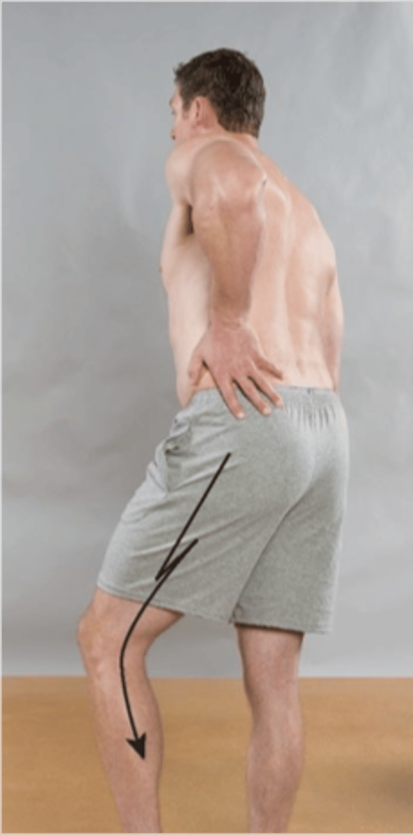 <p>The _____ is present if the patient flexes the knee on the affected side and if trunk flexion causes pain in the leg</p>