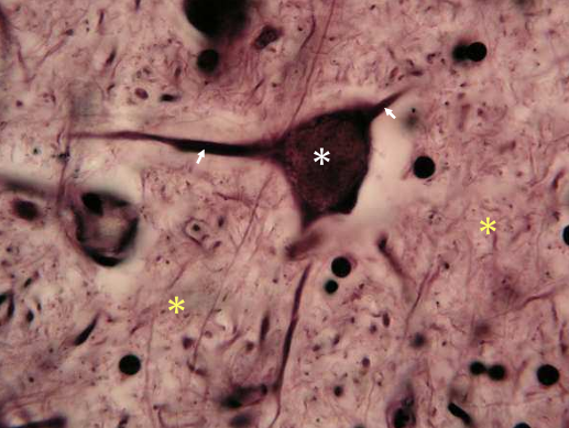 <p>impregnação pela prata </p>