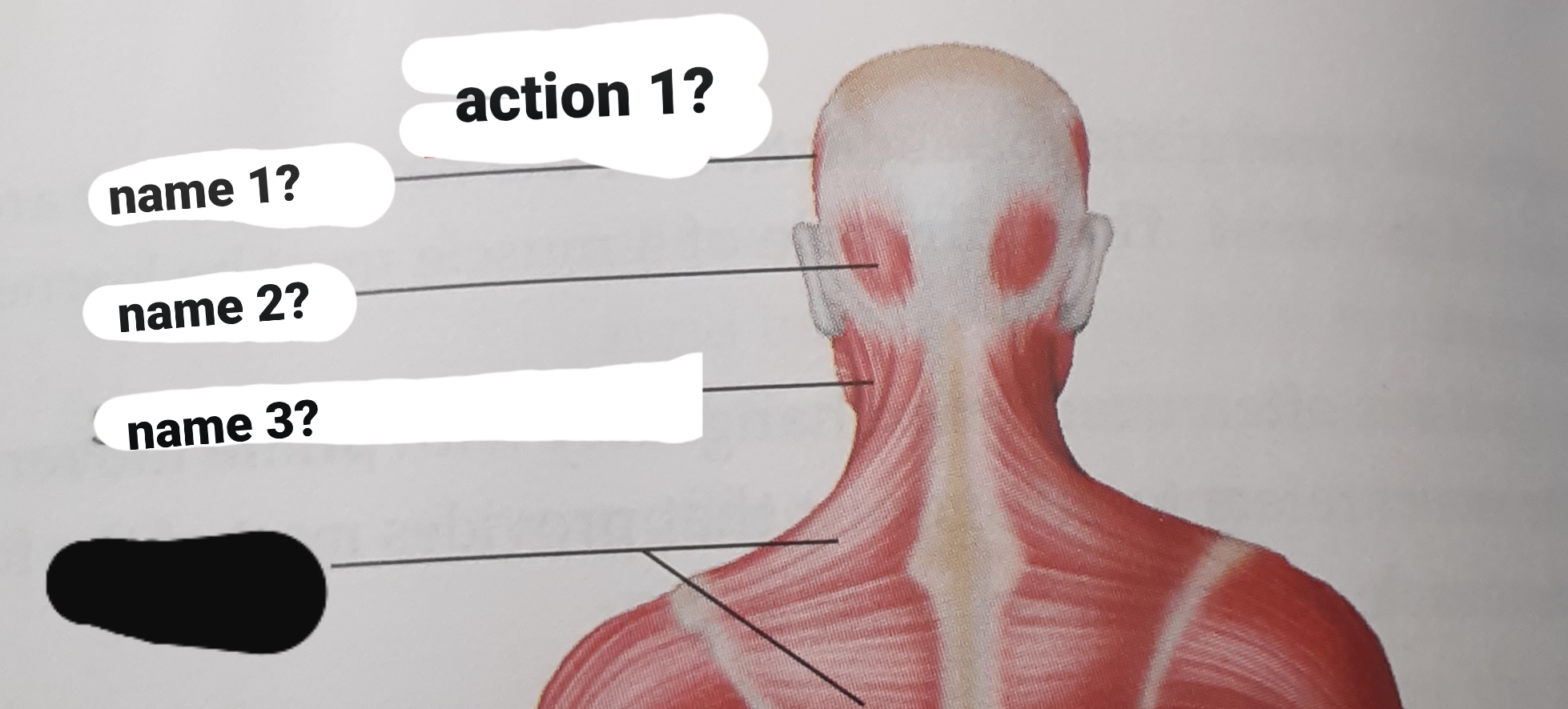 <p>sternocleidomastoid</p>