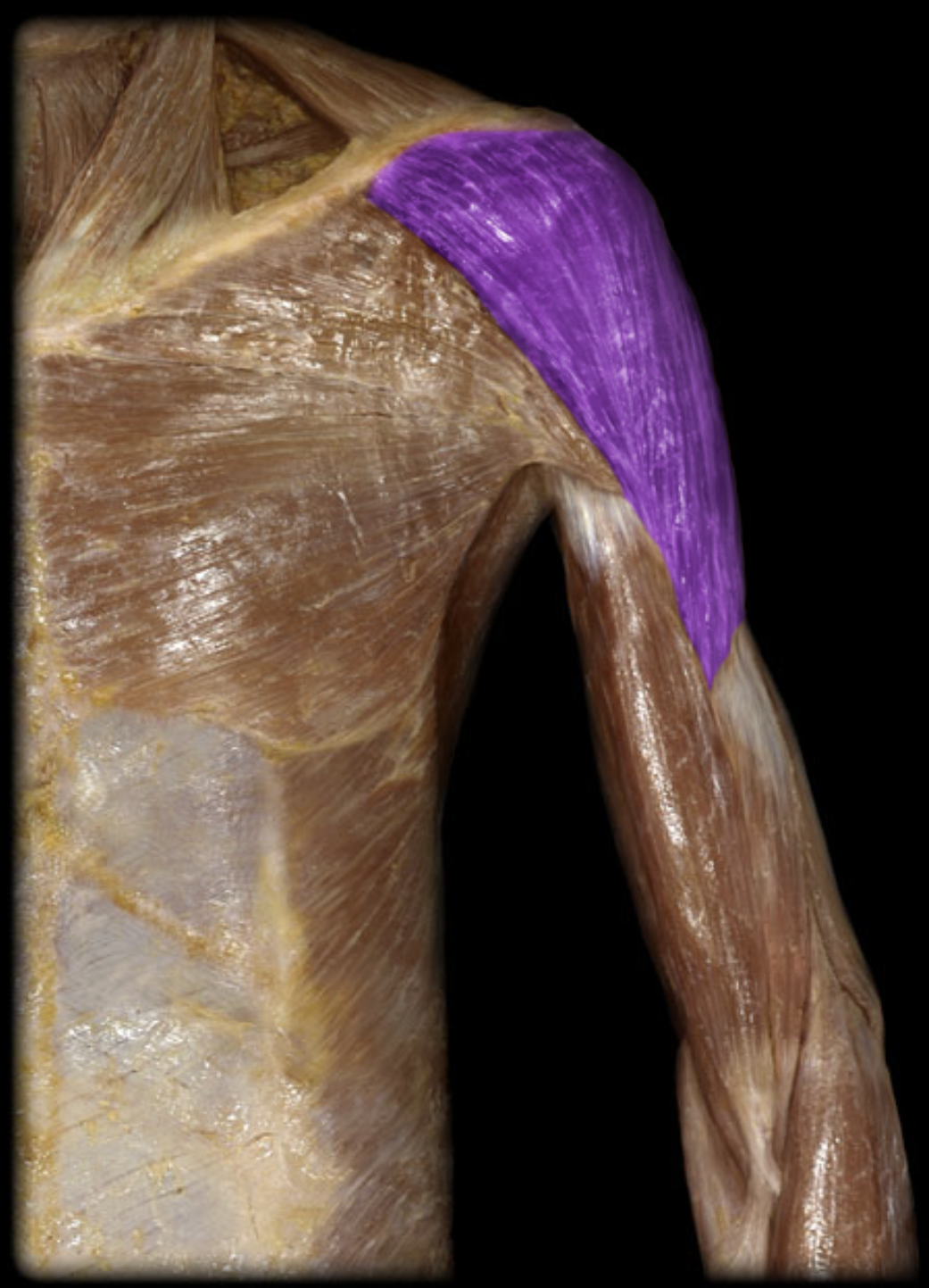 <p>What muscle is this?</p>