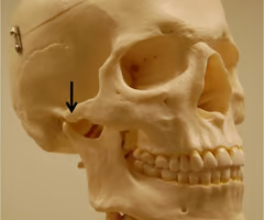 <p>forms the zygomatic arch with the zygomatic process of the temporal bone</p>
