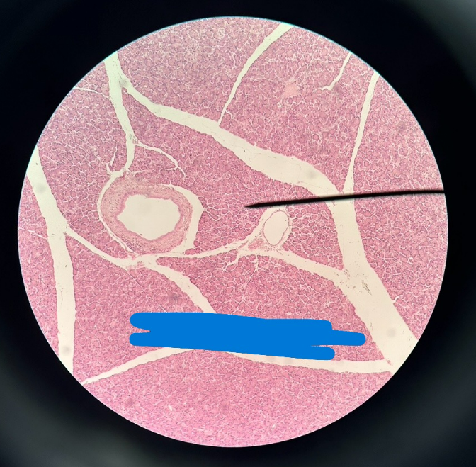 <p>What organ is this?</p><p>What are the names of the light structures?</p><p>What is the name of the darker cells around?</p>