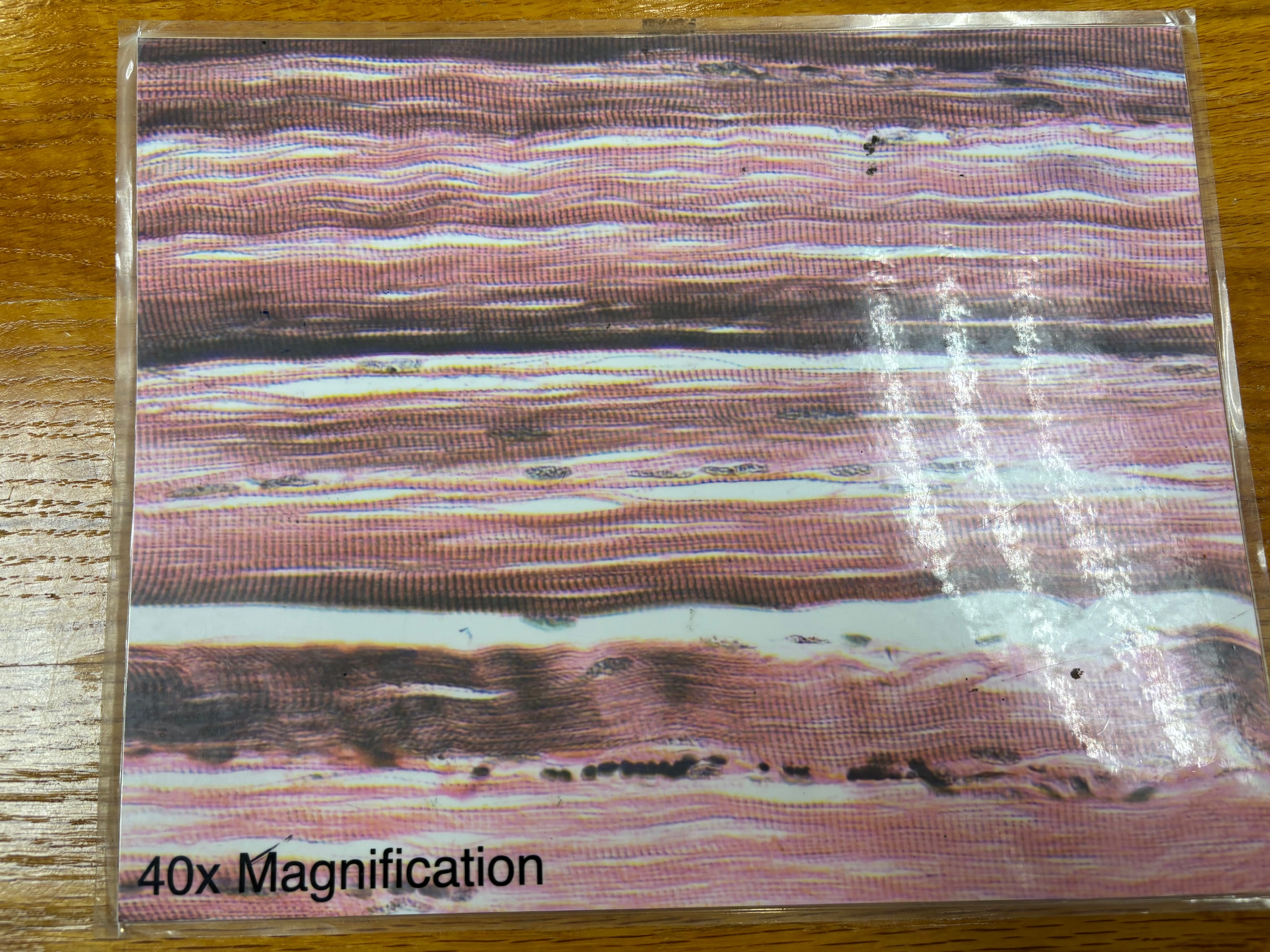 <p>remember striations, sarcomeres</p>