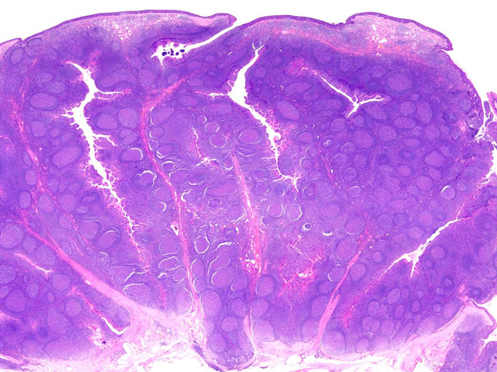 <p>What is this a slide of ?</p>