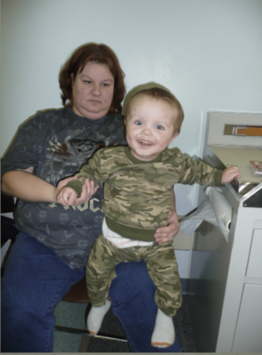 <p>Hypochondroplasia, 5</p>