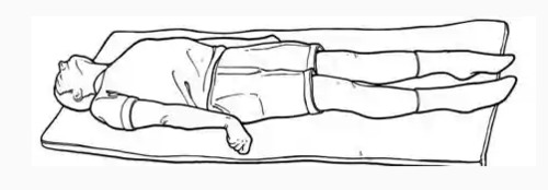 Upper: stiffly extended, adducted, internal rotation, palms pronated. 
Lower extremities: stiffly extended, plantar flexion; teeth clenched; hyperextended back