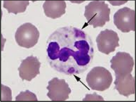 <p>what disease is affecting these and what is it</p>