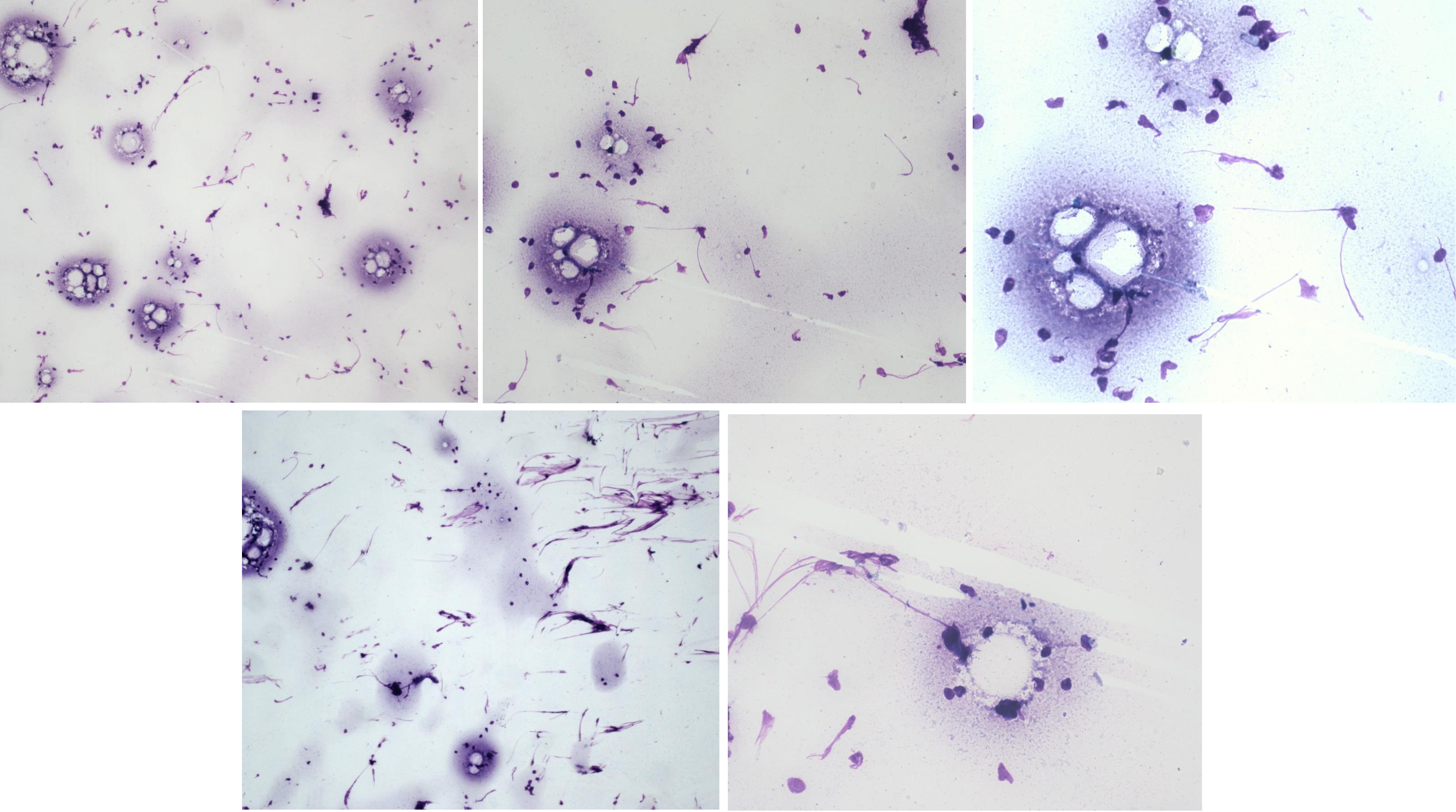 <p>Utstryk 9<br>Parabasalceller: <br>Intermediärceller: <br>Superficialceller: <br>Erytrocyter: <br>Neutrofiler:</p><p>Stadium:</p>