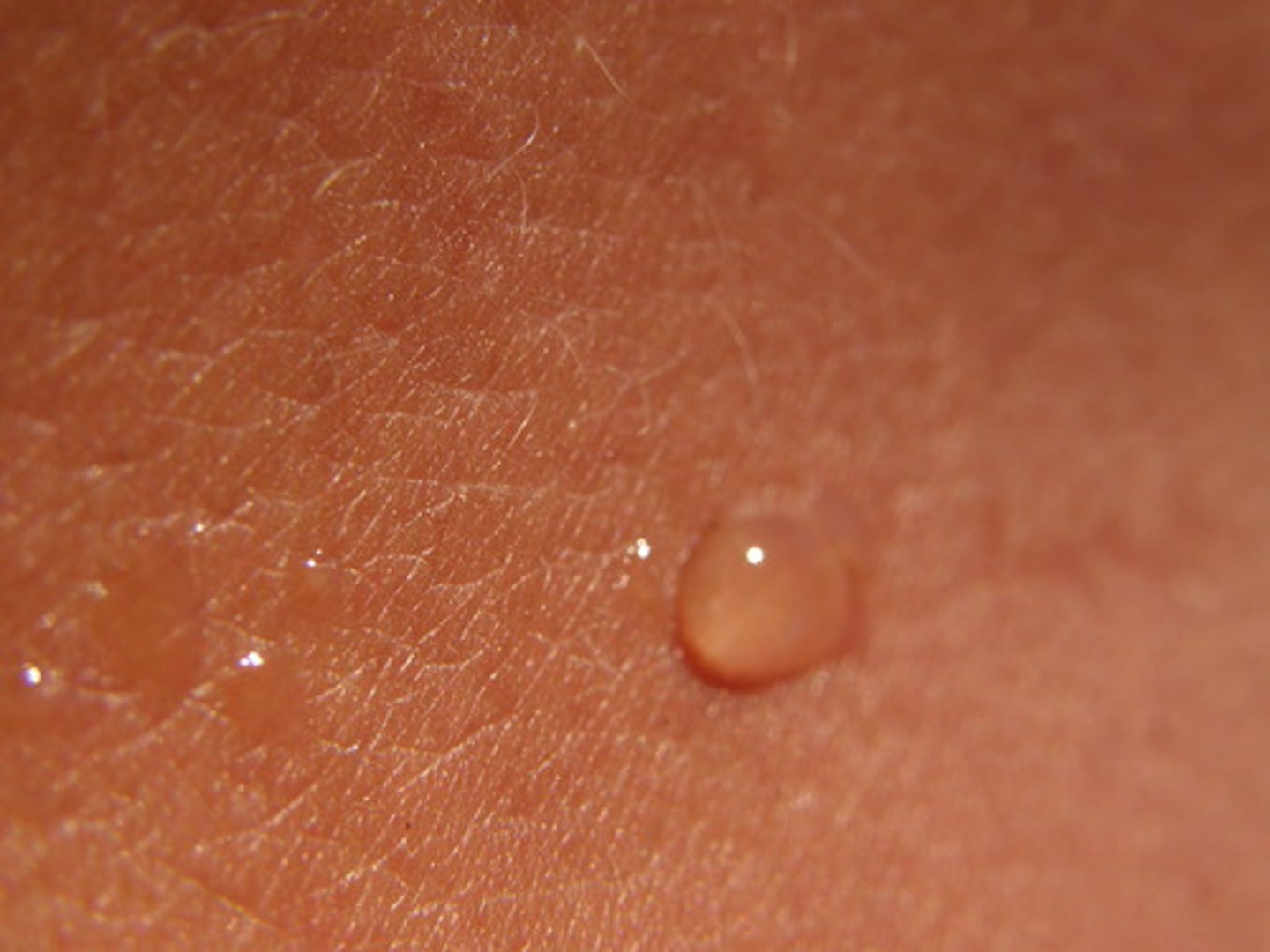 <p>skin or eye absoprtion</p>