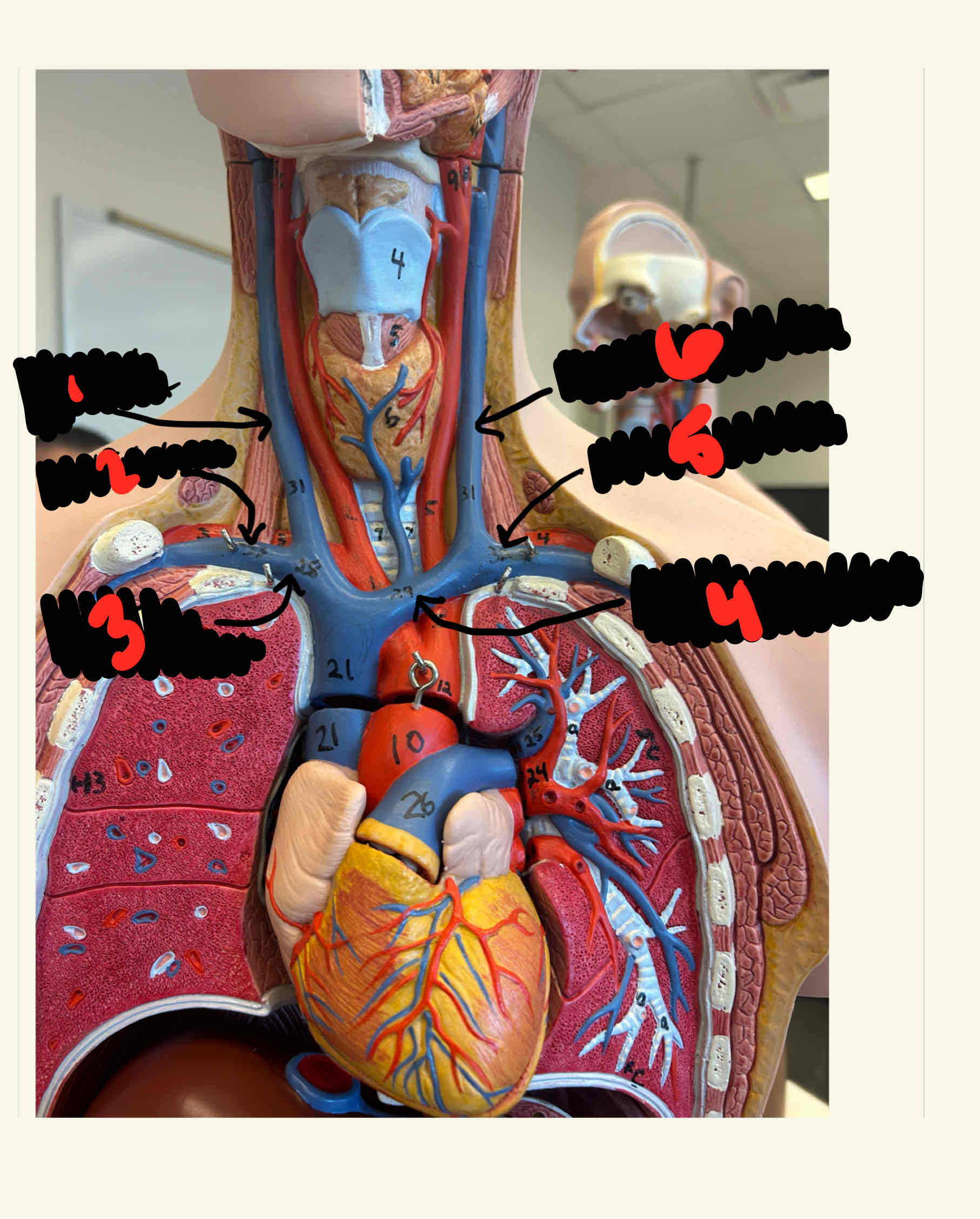 <p>What is the structure labeled 6</p>