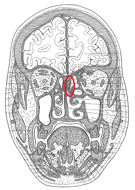 term image