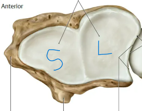 <p>medial lunate<br>lateral scaphoid </p>