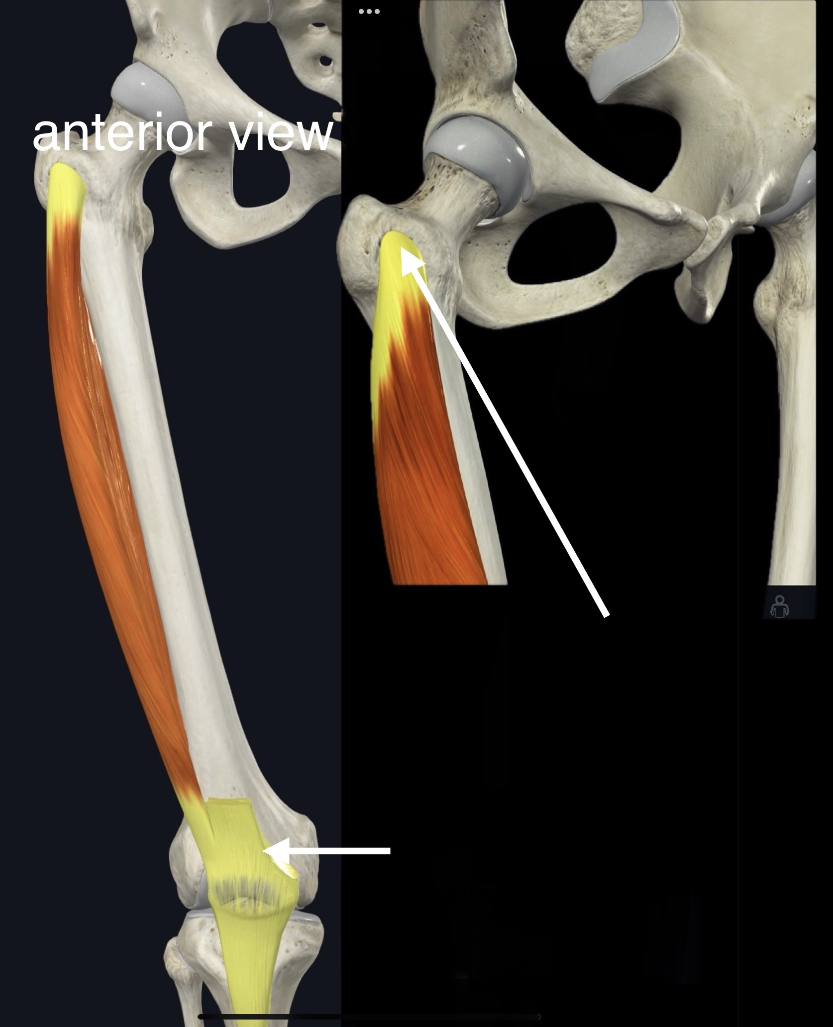 <p>Name the muscle, origin and insertion</p>