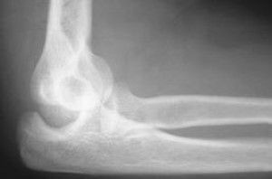<p>What kind of pathology is shown in the image?</p>