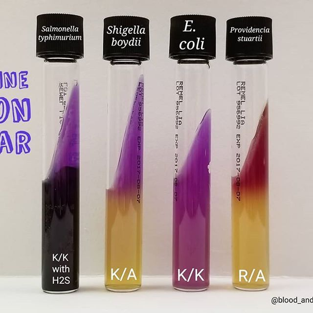 <p>Lysine results </p>