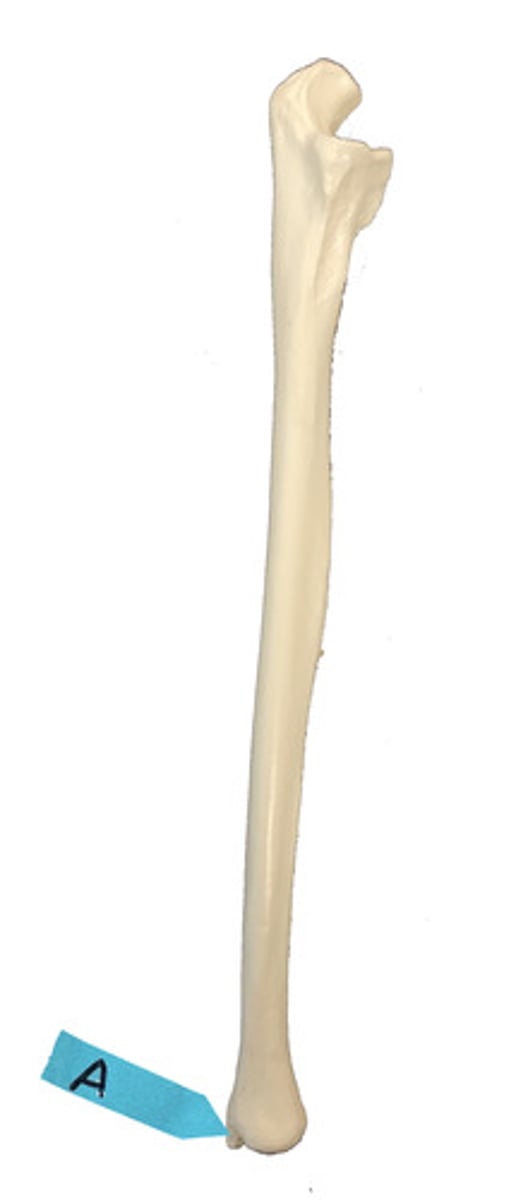 <p>Identify this bone marking.</p>