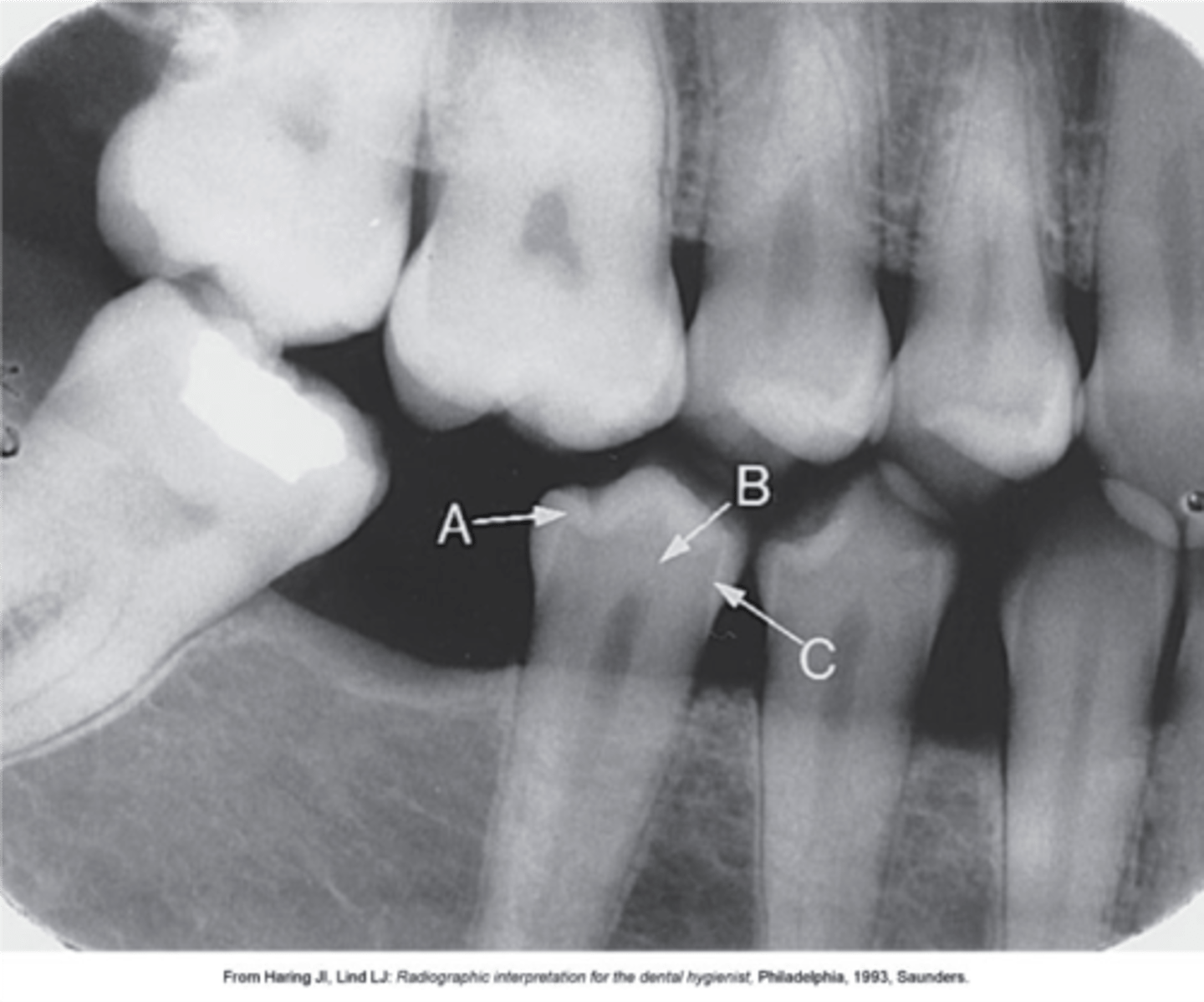 <p>What is arrow A pointing to?</p>