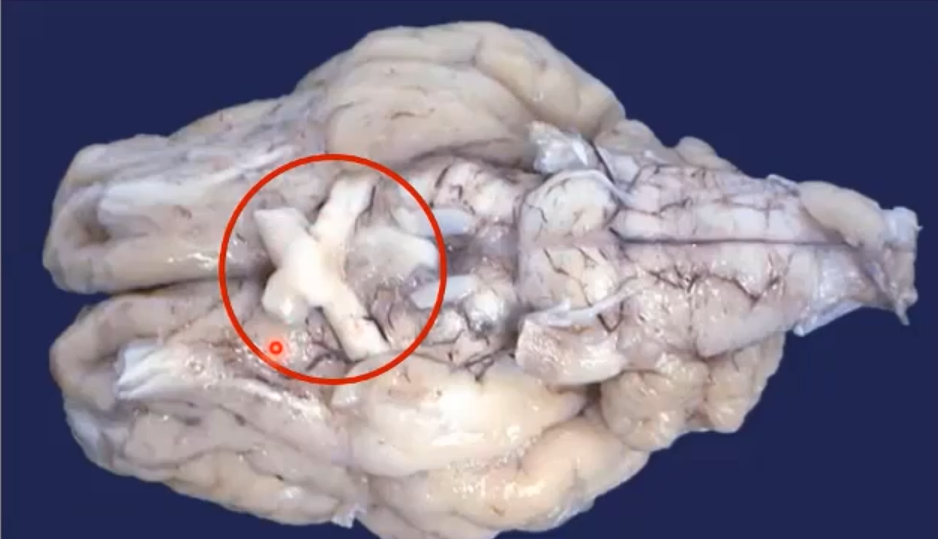 <p>What nerve</p>