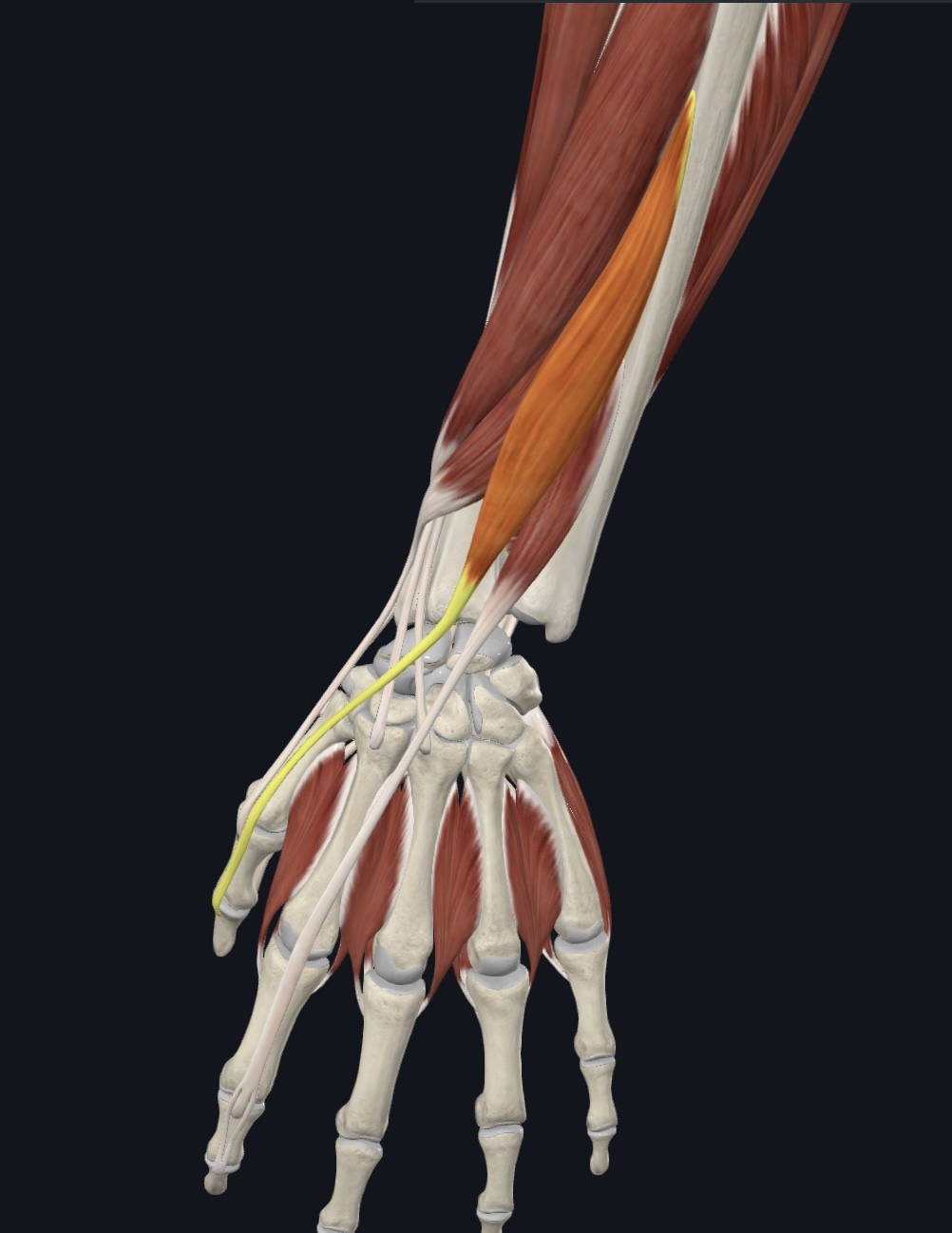 term image