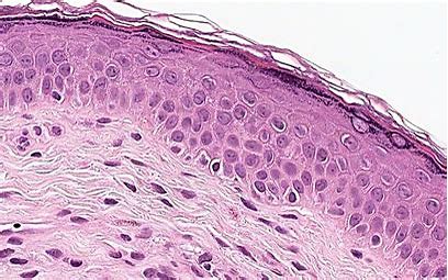 <p>what type of epithelial tissue is this?</p>