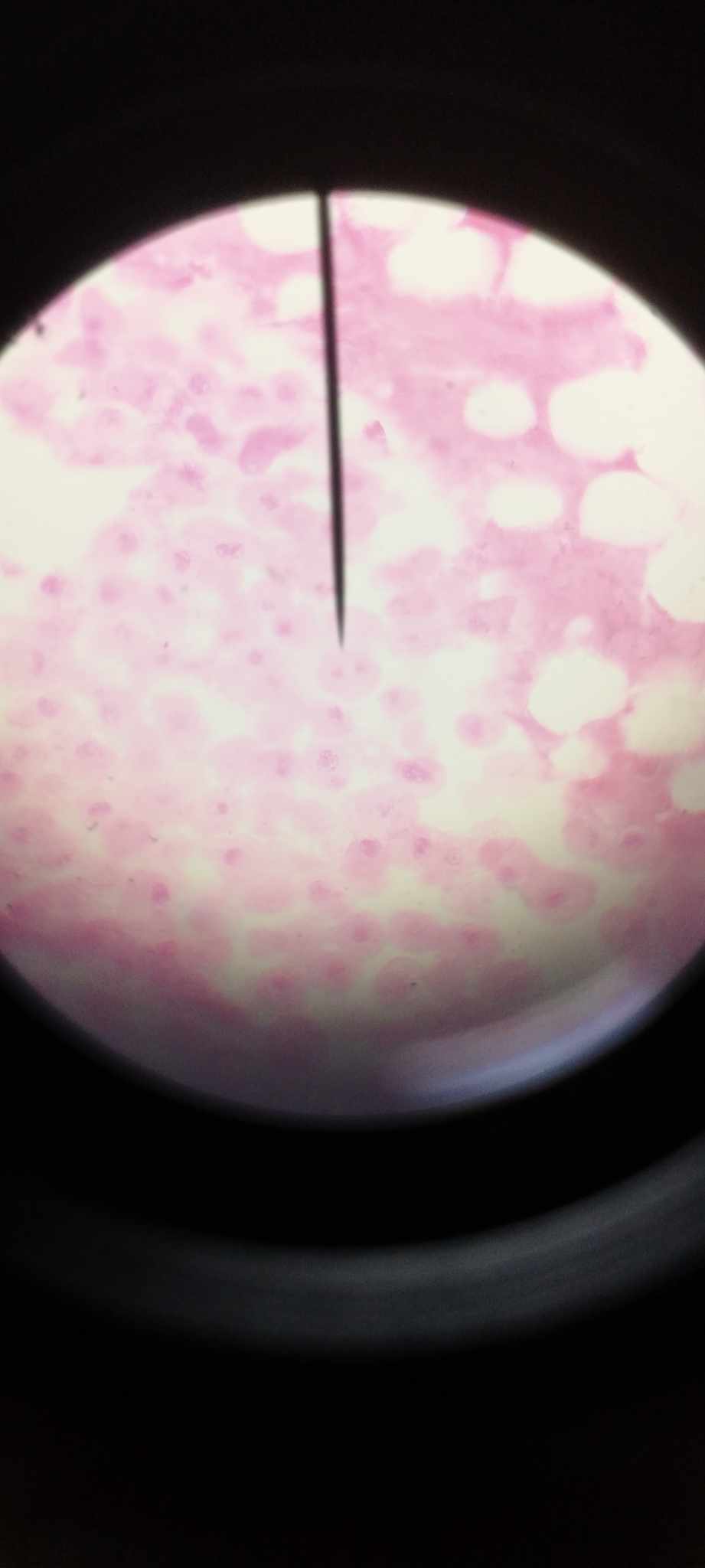<p>sister chromatids of chromosomes separate and start moving towards opposite poles of the cell</p>