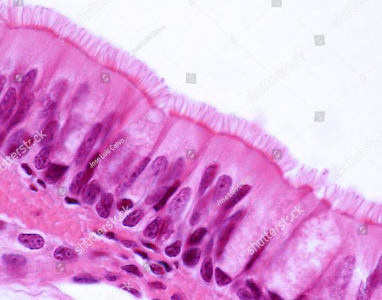 <p>What epithelial tissue is this?</p>