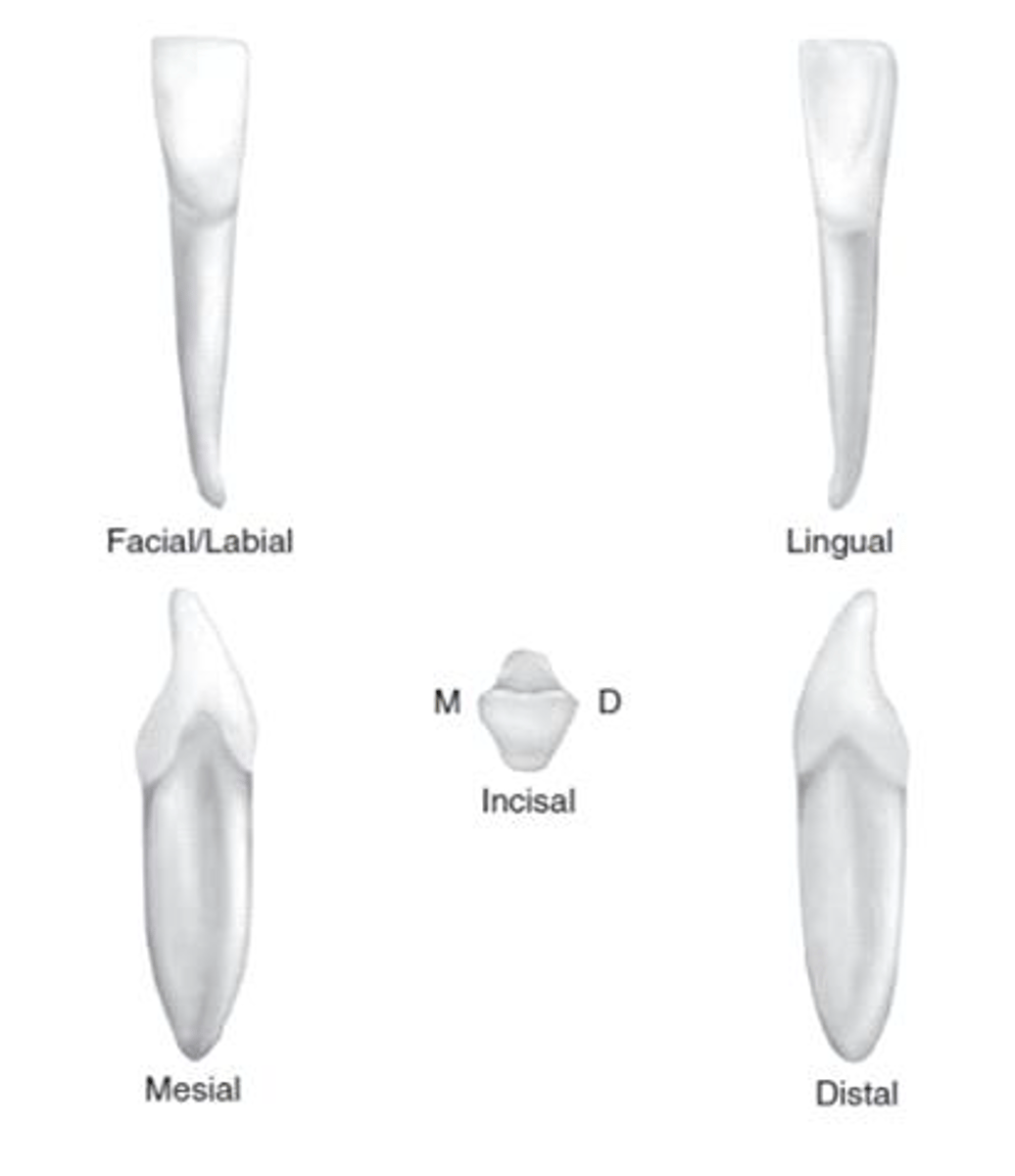 <p>what tooth is this?</p>