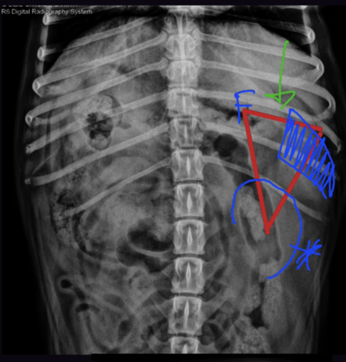 <p>1. Seen only on VD View. Always seen in Cats + dogs</p><p>2. Seen only on Lateral View. seen anywhere between liver + bladder</p><p>3. Head of Spleen, Normal for tail to be seen/not seen in dogs</p><p>4. Head of Spleen, Tail should not be seen in cats</p>