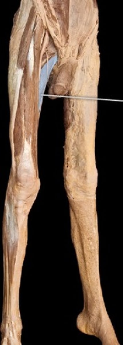 <p>What muscle is this?</p>