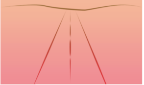 <p><strong>Linear Perspective: </strong>A depth cue utilising the fact that lines converge in the distance. Parallel lines will get closer together or narrower as they appear further from the viewer.&nbsp;e.g. Road/paths.</p>