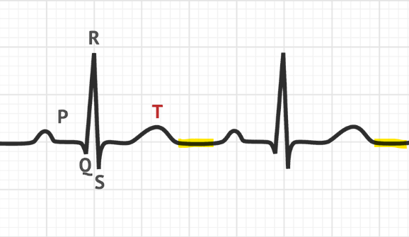 <p>Flat interval showing ventricular diastole (relaxation). </p>