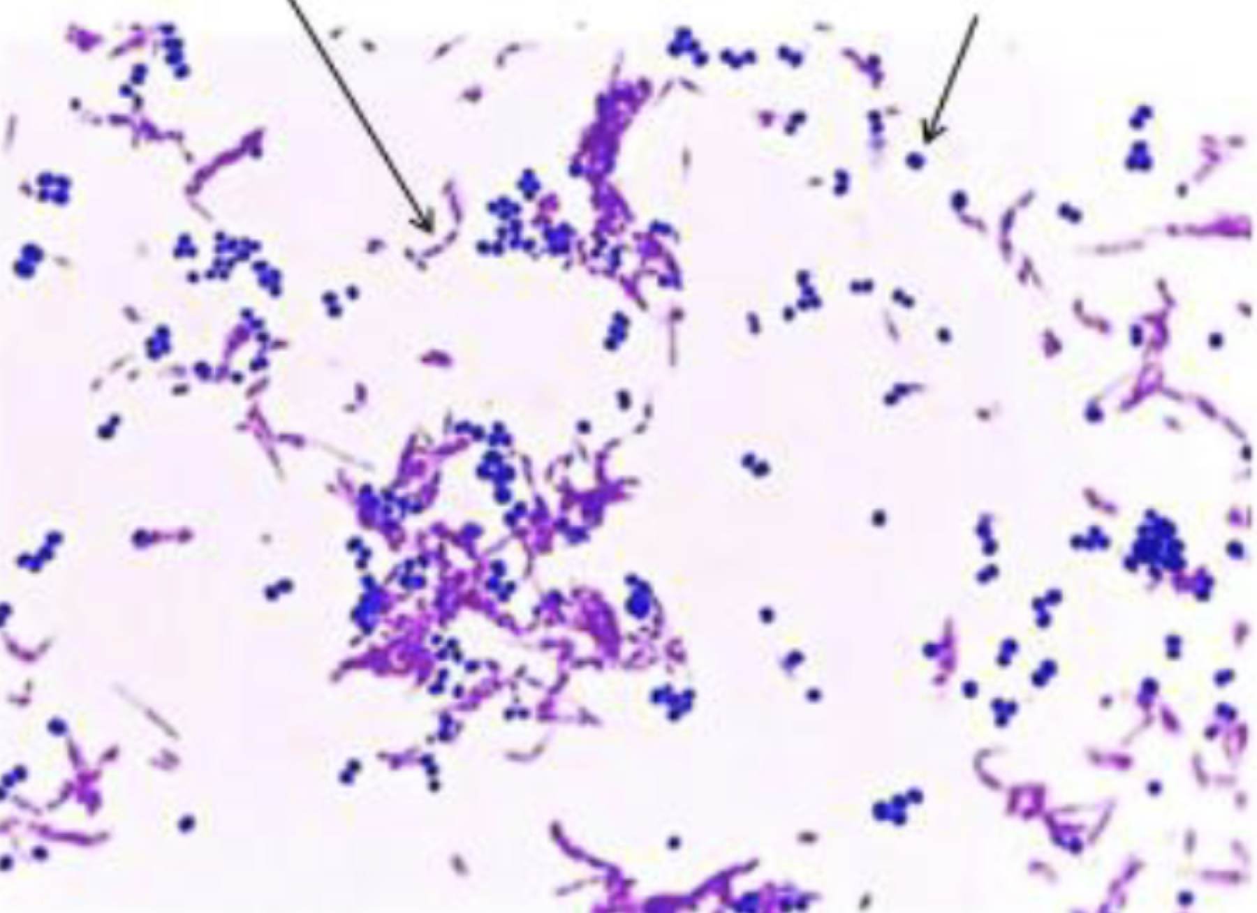 <p>what stain ? what does this say about the bacteria?</p>