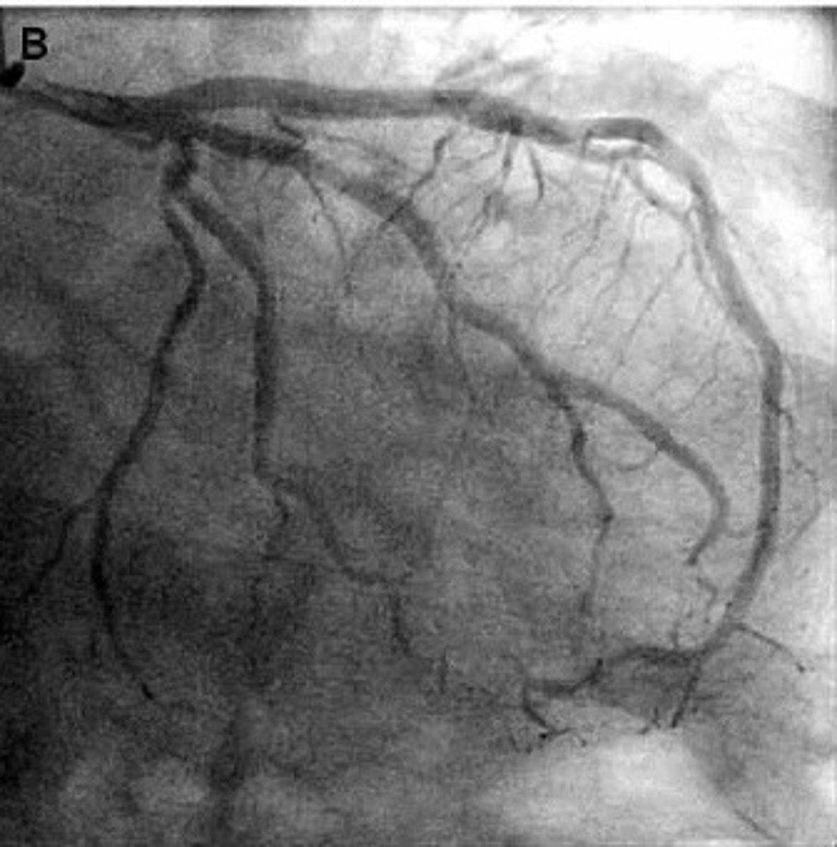 <p>what pathology is present?</p>