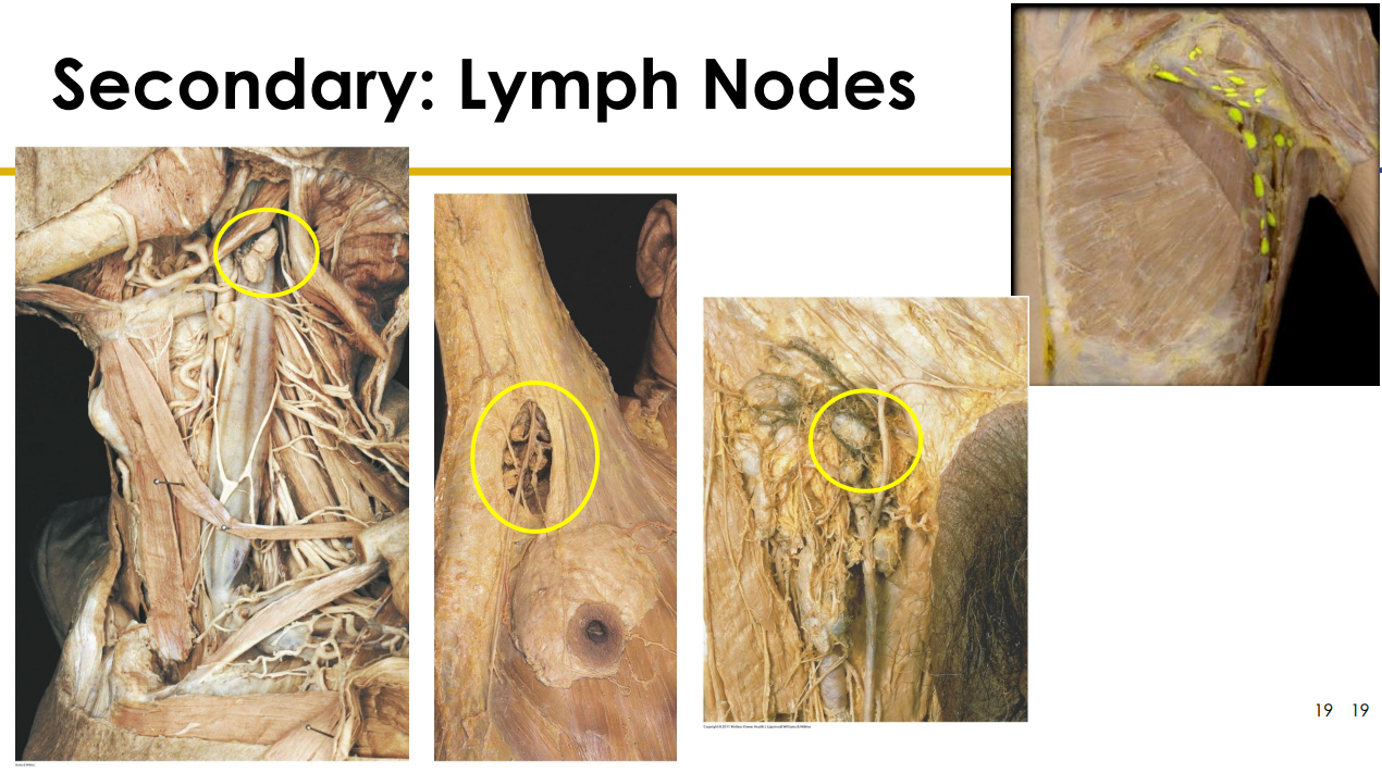<p>Lymph Node Diagram Cadaveric</p>