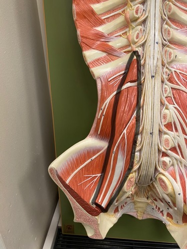 <p>Iliopsoas</p>