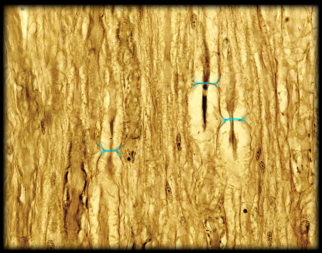 <h4 collapsed="false" seolevelmigrated="true"><strong>Location:</strong></h4><ul><li><p>Myelinated axon</p></li></ul><h4 collapsed="false" seolevelmigrated="true"><strong>Description:</strong></h4><ul><li><p>Cleft between internodes of myelin sheath</p></li></ul><h4 collapsed="false" seolevelmigrated="true"><strong>Function:</strong></h4><ul><li><p>Rapid nerve impulse conduction</p></li><li><p>Impulses "jump" from node to node (a process called saltatory conduction)</p></li></ul><h4 collapsed="false" seolevelmigrated="true"><strong>Comment:</strong></h4><ul><li><p>Myelin sheath segmented (segments called internodes)</p></li><li><p>Latin: saltare = to jump</p></li></ul>