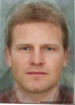 <p>Identify this Phenotype</p>