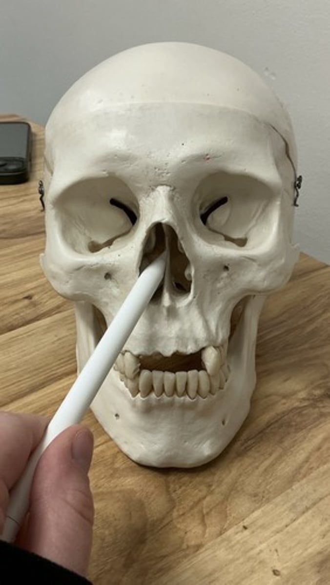 <p>What bone is this?</p>