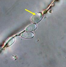 <p>Identify the sperm morphology.</p>