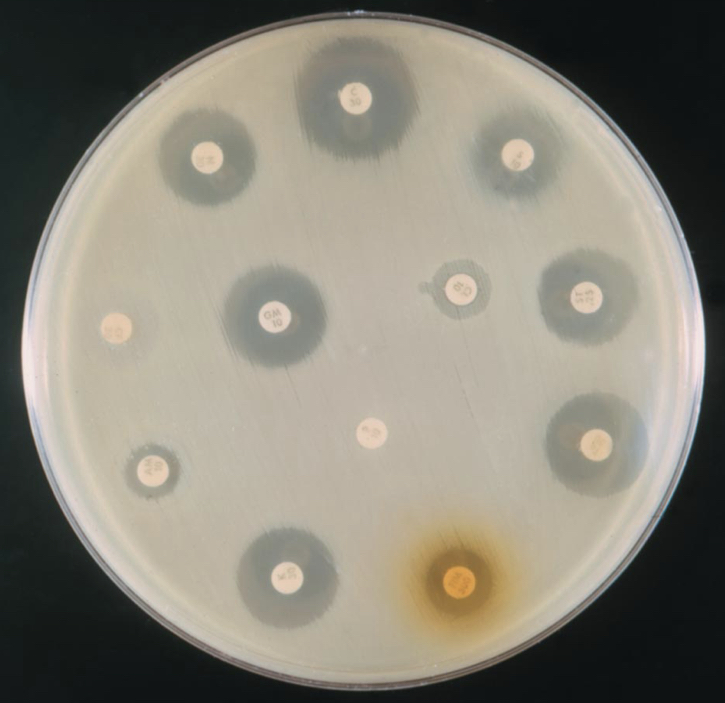 Testing drugs - the disk diffusion method 