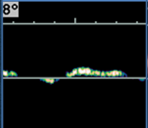 <p>what type of resistance waveform does this show (venous)?</p>