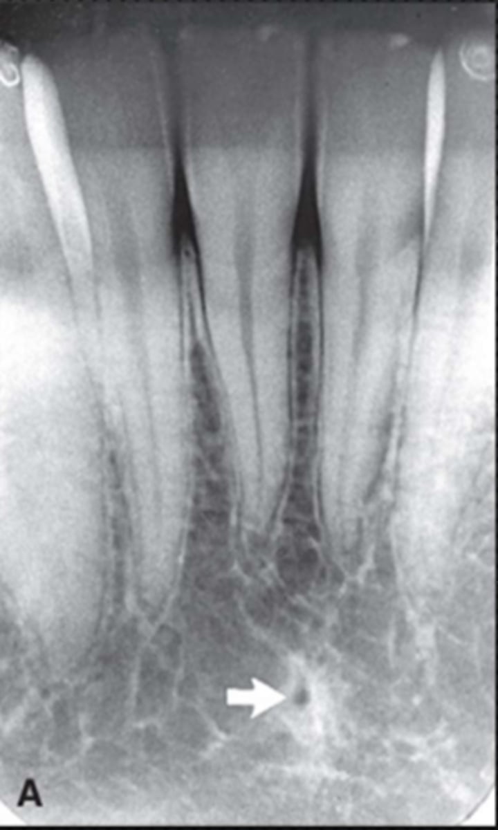 <p>Identify the radiolucent spot</p>