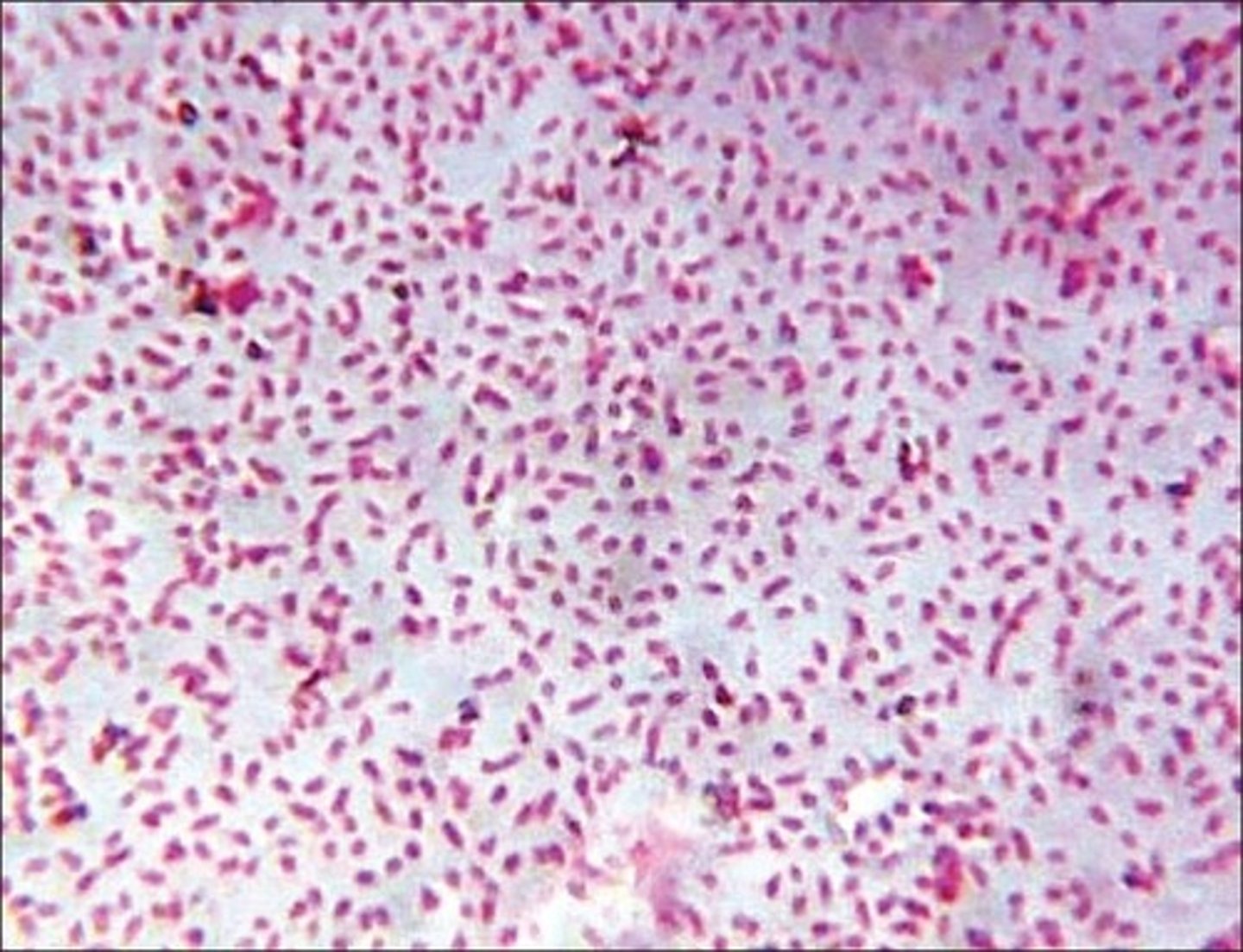 <p>What is the gram stain of Haemophilus influenzae?</p>