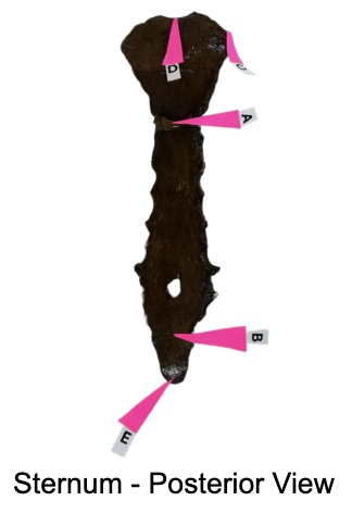 <p>Identify the suprajugular notch</p>