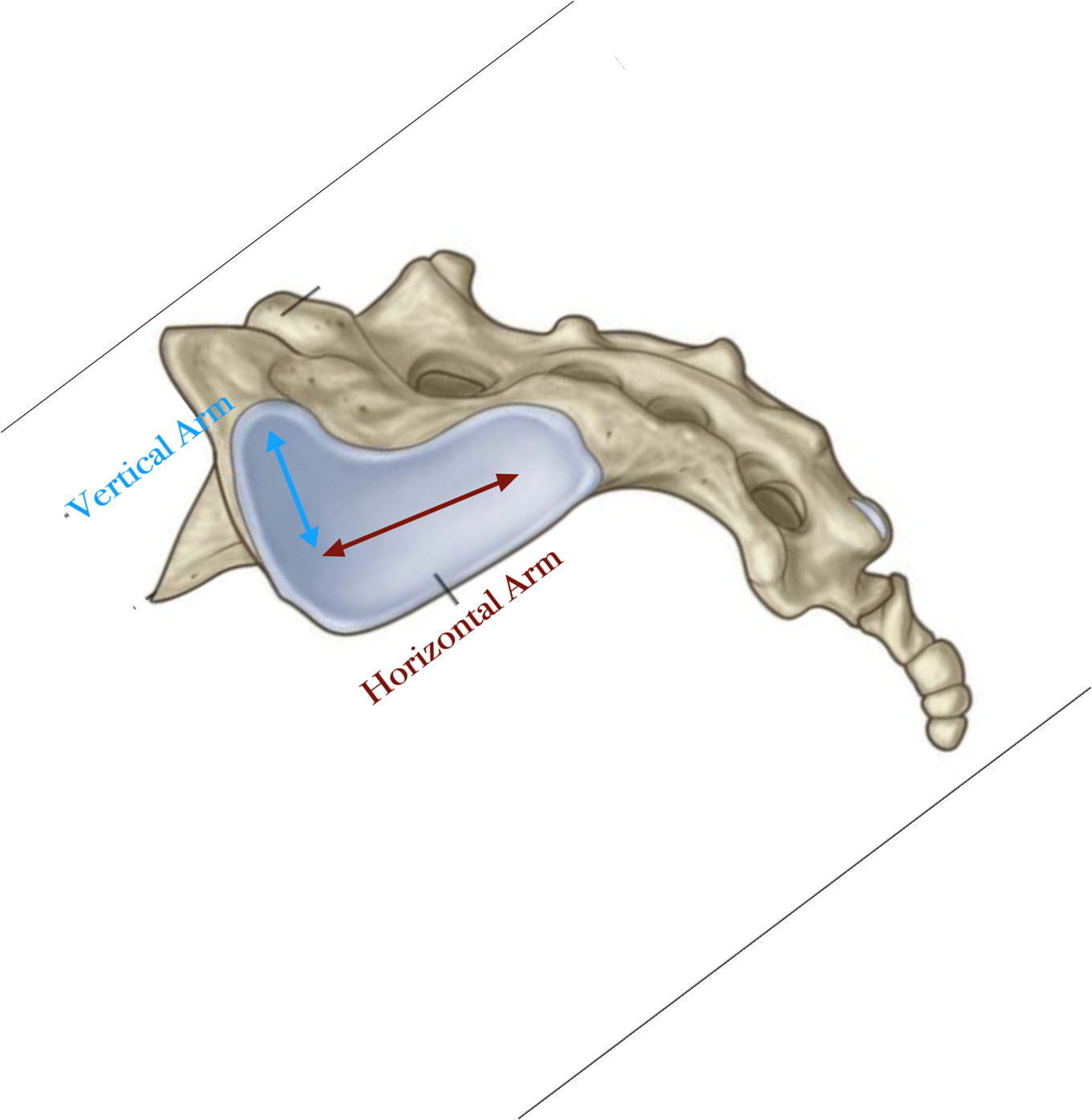 <p><span style="font-family: &quot;Bodoni MT&quot;">The apex of the sacrum will move both superiorly and posteriorly in nutation</span><span>&nbsp;&nbsp;</span><br><br></p>