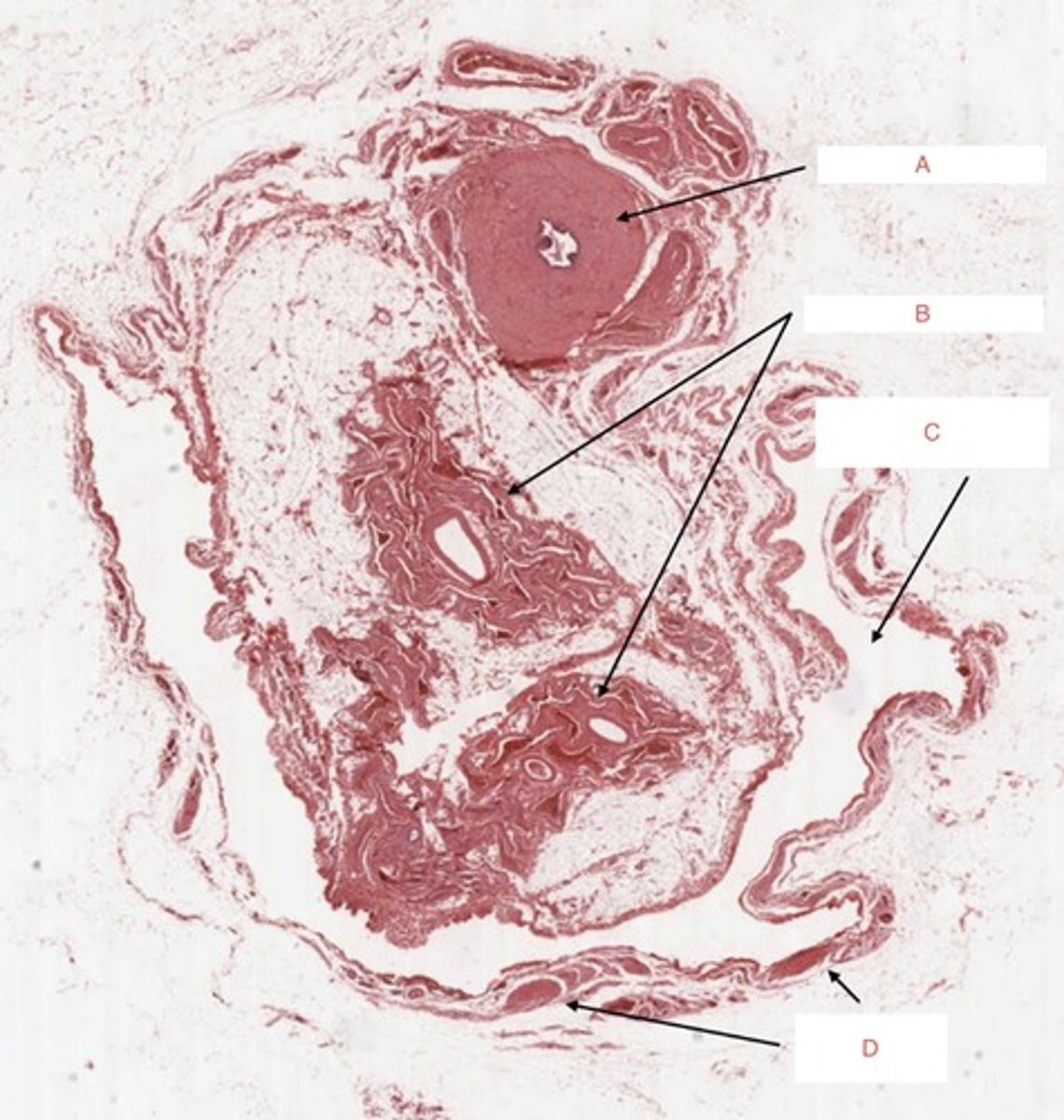 <p>A</p>